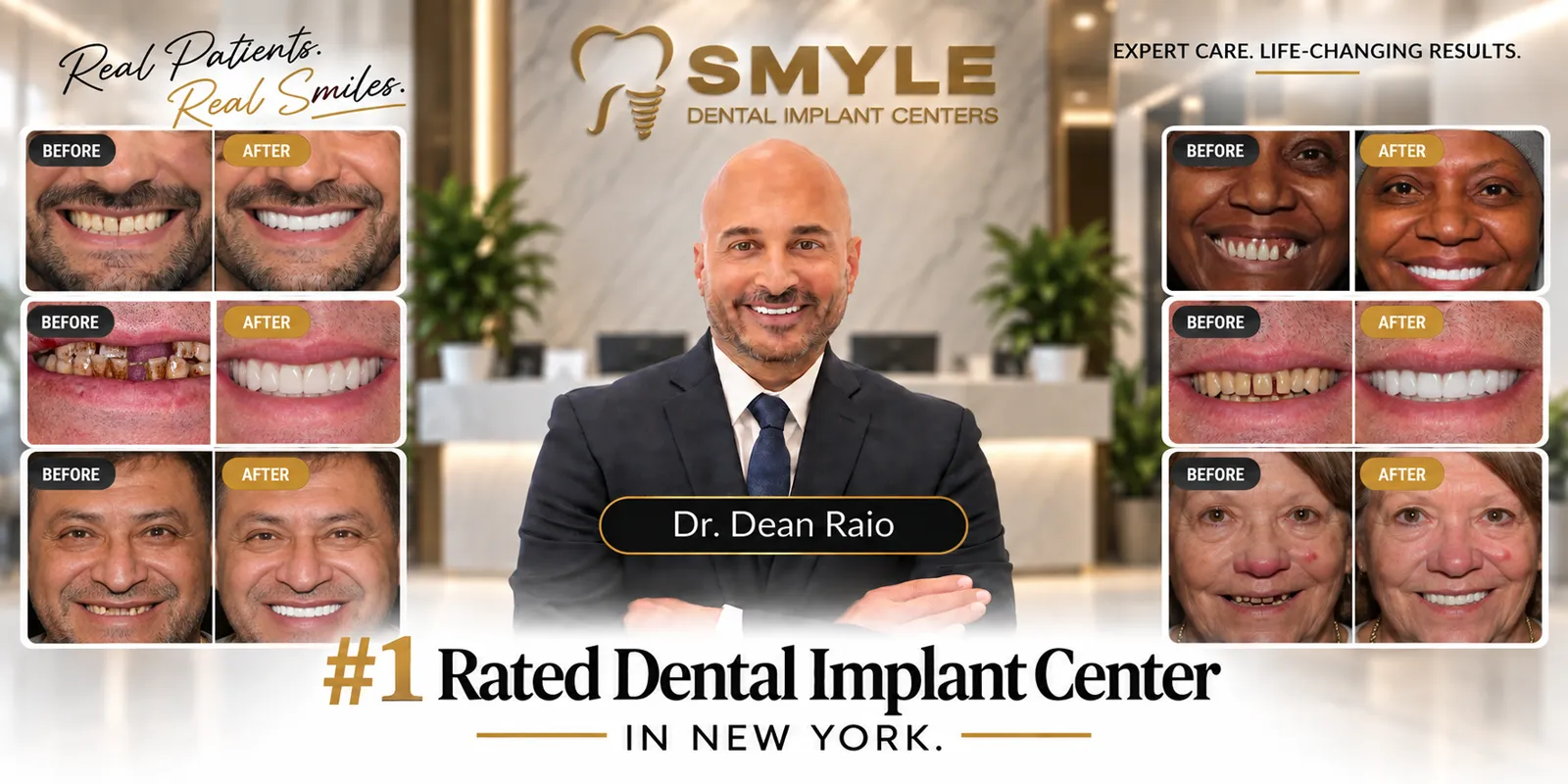 SMYLE Dental Implant Centers with Dr. Dean Raio and patient smile transformations